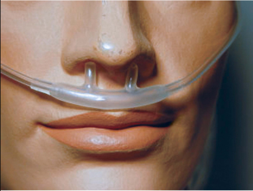 LUNETTE A OXYGENE 